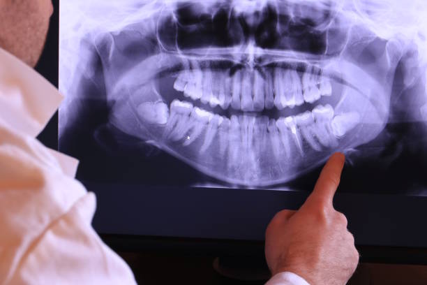 Best 24-Hour Emergency Dentist in Scotts Valley, CA