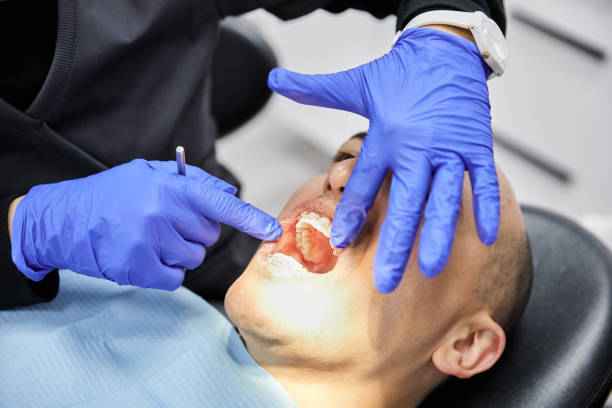 Best Weekend Emergency Dentist in Scotts Valley, CA