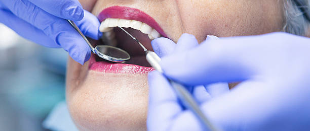 Best Emergency Denture Repair in Scotts Valley, CA